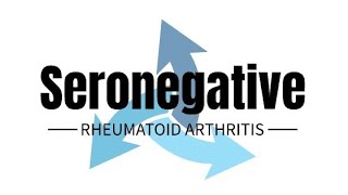 Seronegative Rheumatoid Arthritis rheumatology rheumatoid seronegative [upl. by Otti]