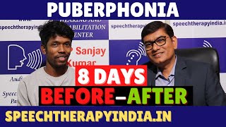 Unbelievable Voice Transformation in Just 8 Days  Puberphonia  SLPSanjayKumar  AIIMS Alumnus [upl. by Raffaj]