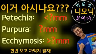 니모닉 Petechia purpura Ecchymosis [upl. by Camp]