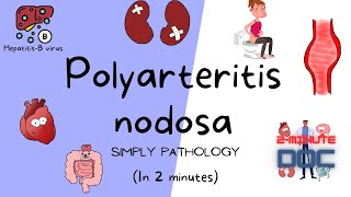 Polyarteritis nodosa Vasculitis  SimplyPathology  2minutedoc [upl. by Efram]