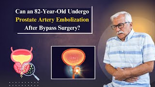 Prostate Artery Embolization in Hyderabad  NonSurgical Treatment  Prostate Surgery nonsurgical [upl. by Shore]