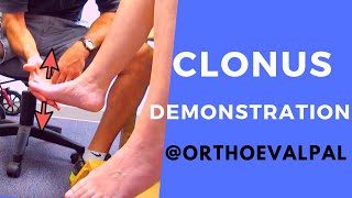 Clonus Demonstration with Ortho Eva Pal [upl. by Anwat]