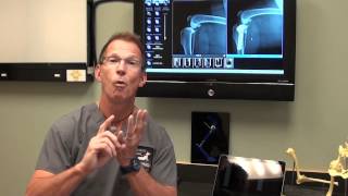 Canine ACL Tears and TPLO Surgery discussed by Dr Bauer DVM DACVS [upl. by Trinee]