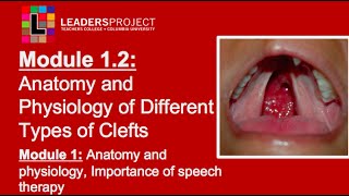 Module 12 Cleft Palate Speech and Feeding Anatomy and Physiology of Cleft Lip and Palate [upl. by Kushner]