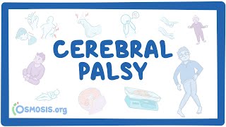 Cerebral palsy CP  causes symptoms diagnosis treatment pathology [upl. by Itagaki]