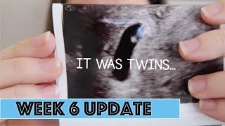 IT WAS TWINS  6 WEEK PREGNANCY UPDATE  The Hebert House [upl. by Htebezile444]