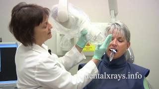 How to take dental xrays with bisecting angle positioning [upl. by Derf]