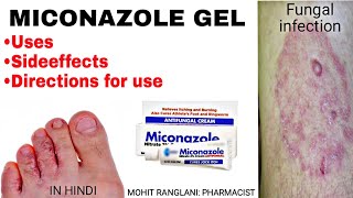 Miconazole nitrate cream  Uses sideeffects directions  Fungal infection treatment in Hindi [upl. by Erich493]