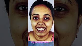 Best Maxillofacial Surgery in India [upl. by Airreis989]