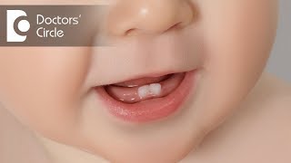 How long does it take for a baby to teeth  Dr Raju Srinivas [upl. by Gruber]