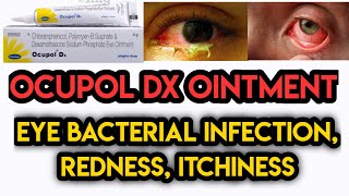 Ocupol Dx Eye Ointment Review in Hindi [upl. by Toby]