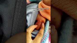 Vaccination child birth dosevaccine pregnacnycqreshortsvideoshortsvaccinationinindia who [upl. by Tersina862]