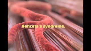 Behcet syndrome [upl. by Laetitia119]