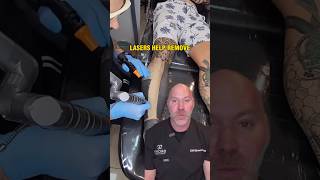 How Laser Tattoo Removal Works 💥 [upl. by Maclean401]