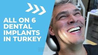 All On 6 Dental Implants in Turkey [upl. by Jarrid]