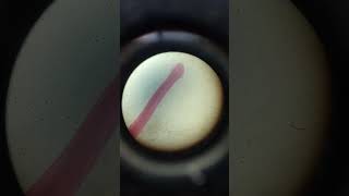 Ancylostoma whole mount zoology practical lab 🧪shorts [upl. by Zitah]