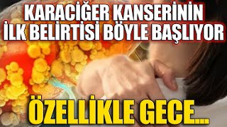 Karaciğer Kanserinin İlk Belirtisi Böyle Başlıyor Özellikle Gece [upl. by Haila]