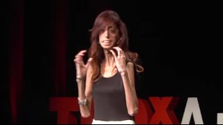 How do you define yourself  Lizzie Velasquez  TEDxAustinWomen [upl. by O'Carroll572]