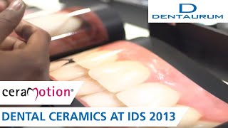 The ceraMotion® moment  dental ceramics at IDS 2013 [upl. by Mloc]