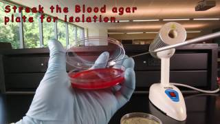 Inoculating Blood Agar and Adding a Novobiocin NB Disc [upl. by Yeffej]