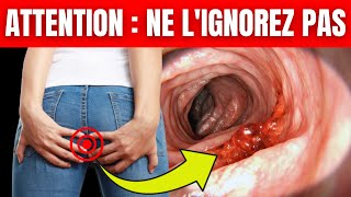 7 Symptômes URGENTS de Cancer du Côlon [upl. by Nhguaval117]