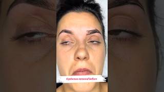 Shape sourcils avant microblading microblading microbladingeyebrows microbladingeyebrows microb [upl. by Adnawyek]