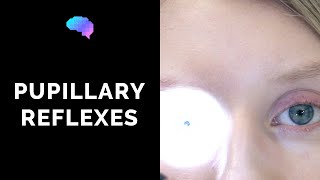 Pupillary Reflexes  OSCE Guide Clip  UKMLA  CPSA [upl. by Nilesoj512]