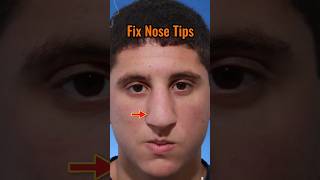 Fix nose tip and get SLIM NOSE viral attractive handsome [upl. by Clarine]