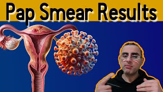 Pap Smear 101  Explained Pap Smear results meaning Pap Test [upl. by Baily]