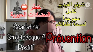 Scarlatine 🦠التهاب او تعفن اللوزتين لحلاقم [upl. by Trout]