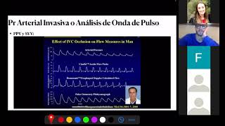 Shock y Monitoreo Hemodinamico Funcional Parametros Dinamicos II [upl. by Arreyt]