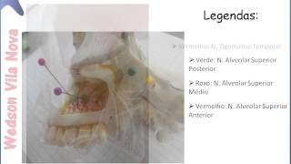 NervoTrigêmeo SLIDE  Anatomia Prática [upl. by Guerra]