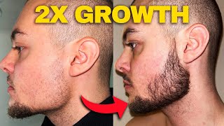 Minoxidil Beard Growth  How To Double Your Minoxidil Beard Growth Results [upl. by Ellord]