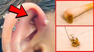 CLEAN Your Piercings Or THIS Can Happen…REMOVAL [upl. by Jackelyn307]