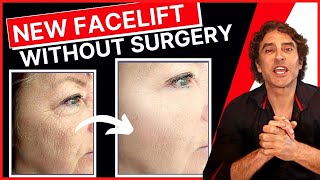 NEW PROCEDURE Facelift WITHOUT Surgery 🔥 Ellacor Micro Coring [upl. by Yessak]