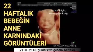 22 haftada anne karnındaki bebeğin dört boyutlu ultrason görüntüleriDr Kağan Kocatepe [upl. by Selina]