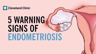 5 Warning Signs of Endometriosis [upl. by Enelrats192]