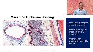 MD DNB Practical CONNECTIVE TISSUE STAINS Massons Trichrome Univ Exam [upl. by Haelem]