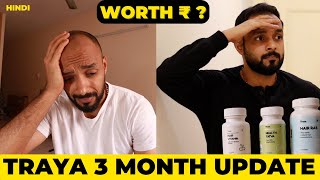 ✅ Traya Hair Regrowth👩‍🦲3 Month Progress Update 👉 My Honest Opinion 🟡 from hair loss to Thicker Hair [upl. by Dlonyar639]