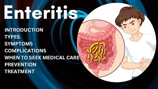 What is Enteritis  Enteritis Prevention and Treatment [upl. by Dionis]