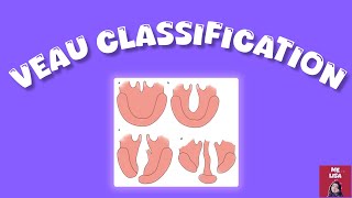 Cleft Lip An Palate Classification VEAU CLASSIFICATION [upl. by Hamforrd]