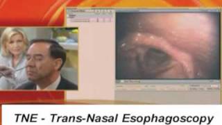 TNE TransNasal Esophagoscope Endoscopy Endoscope GMA [upl. by Enail]