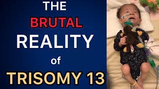 The BRUTAL Reality of Having a Trisomy Child Trisomy 13 amp 18 13トリソミー [upl. by Alacim574]