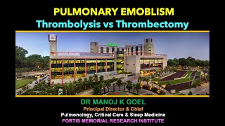 Thrombolysis vs Thrombectomy in Pulm Embolism [upl. by Eimirej]