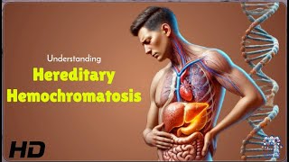 Hereditary Hemochromatosis Are You at Risk [upl. by Daigle]