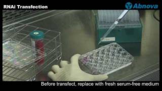 RNAi Transfection [upl. by Haldi]