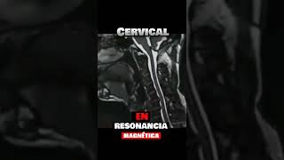 ⚡Cervicales En RESONANCIAFlexión y extensión del cuello [upl. by O'Dell607]