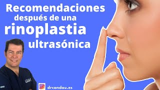 Recomendaciones después de una Rinoplastia Ultrasónica [upl. by Cresida]