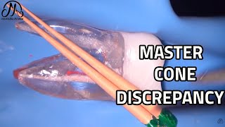 Master Cone Discrepancy  Fitting The Gutta Percha Master Cone  EndoTactics [upl. by Royden646]