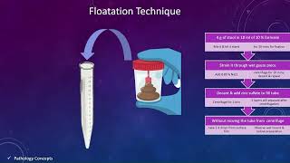 Concentration techniques in Stool  Floatation techniques  Sedimentation techniques  parasites [upl. by Imrots]